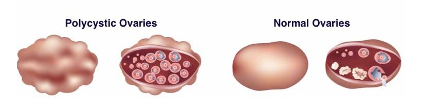 Fertility Factors Jacksonville Center For Reproductive Medicine