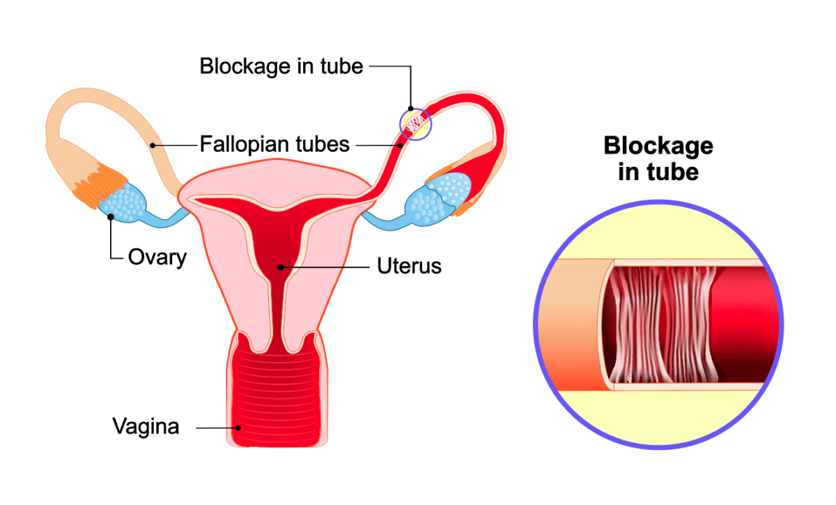 Fertility Factors Jacksonville Center For Reproductive Medicine 6657