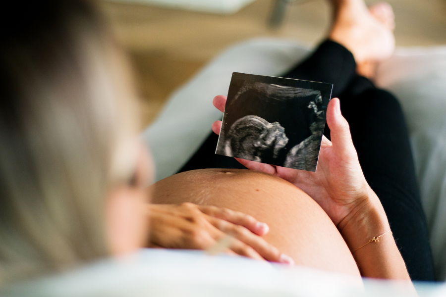 pregnant woman with exposed belly laying back on couch looking at image of ultrasound